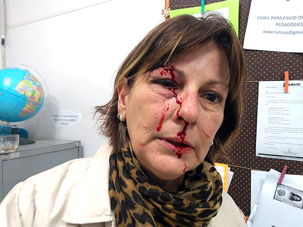 A professora Marcia Friggi, 51, agredida no interior de Santa Catarina por aluno de 15 anos
