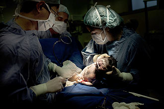 Mdicos trabalham no parto da dona de casa Marcilia de Jesus Claudino, realizado no HCor (Hospital do Corao); beb foi operado