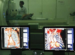 Monitores mostram a tomografia feita com o novo aparelho instalado no Hospital Sírio-Libanês