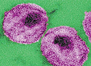 Detalhes da estrutura do HIV; vírus é mais vunerável às drogas porque não cai na corrente sanguínea, diz estudo