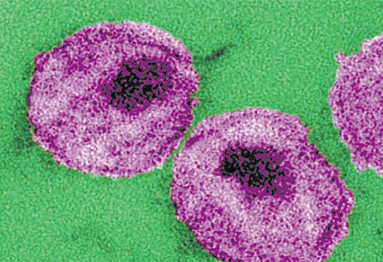 Detalhes da estrutura de partículas do vírus HIV, visualizadas com microscopia eletrônica