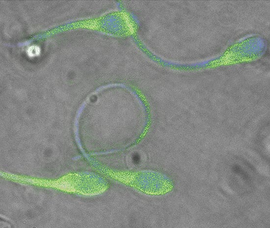 Imagem em microscópio mostra esperma humano de doador que possui somente o gente mutante DEFB126