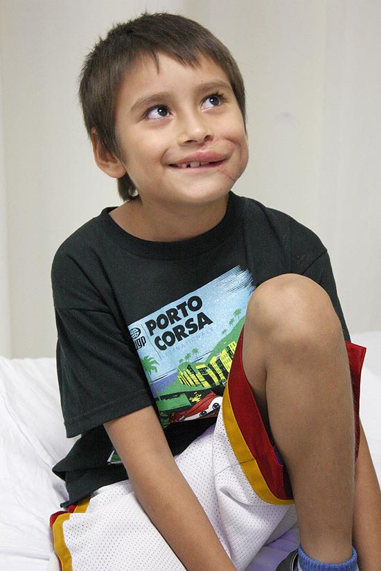 O garoto Raúl Carrizales Jaramillo após receber o reimplante de rosto