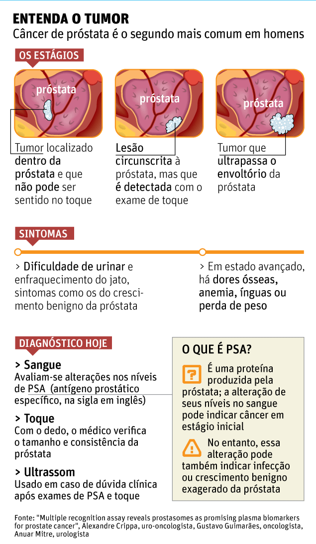 Exame PSA: Saiba Mais e Faça Agora