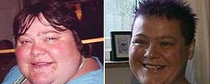 Mulher antes e depois de emagrecer (BBC)