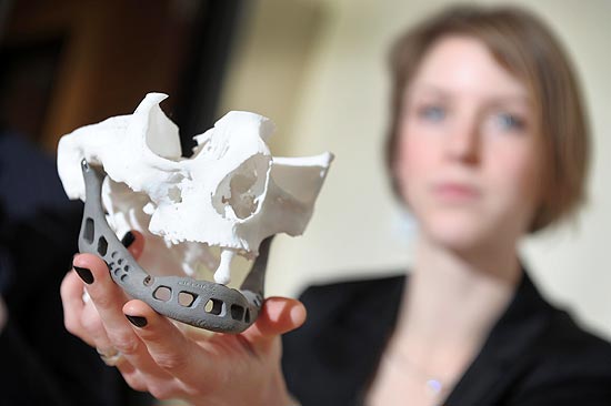A médica Ingeborg van Kroonenburgh exibe a mandíbula artificial durante entrevista à imprensa na Bélgica