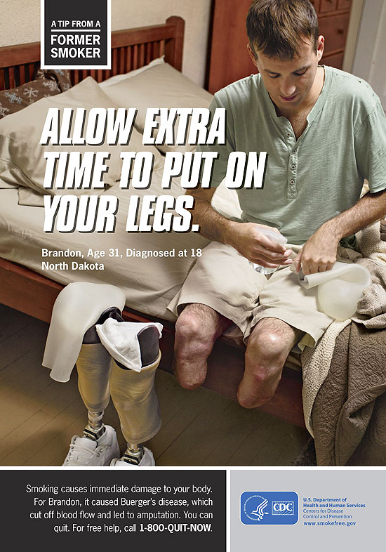 Foto mostra homem com pernas amputadas e a indicação de "dica": "Reserve tempo para colocar suas pernas" 