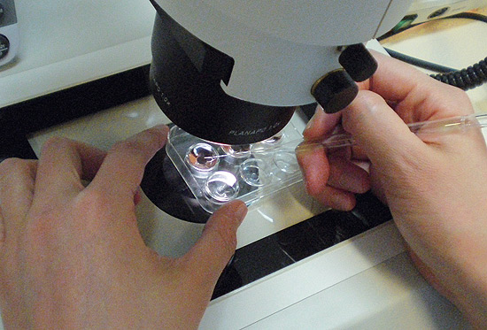 Processo de vitrificação de óvulos na clínica espanhola de reprodução assistida IVI