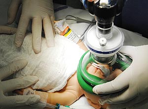 Apelidado de Brigadeirinho, boneco participa de simulao de transplante de fgado