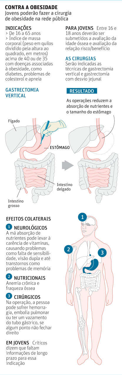 CONTRA A OBESIDADE Jovens poderão fazer a cirurgia de obesidade na rede pública