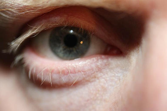 Testes podem detectar esquizofrenia no 'olhar', indica estudo