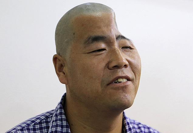 O paciente de sobrenome Hu, 46, que terá crânio reconstruído em cirurgia 