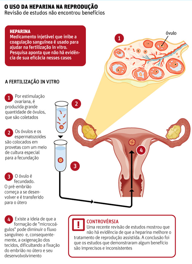 Fertilização in vitroHeparina