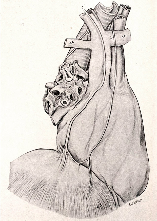 Desenho de um corao, por Lillly Ebstein