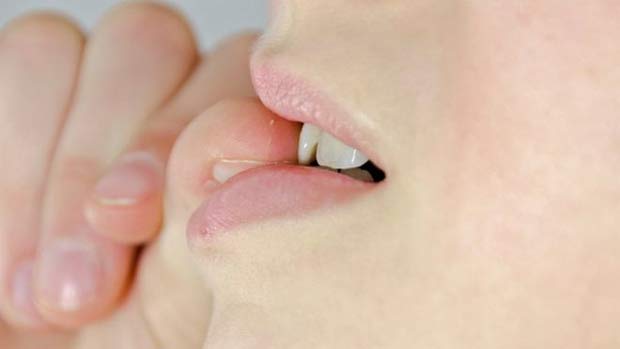 Crianas que chupam o dedo ou roem as unhas tm menos alergias, indica estudo. Segundo pesquisa, hbitos criticados tm efeitos positivos 