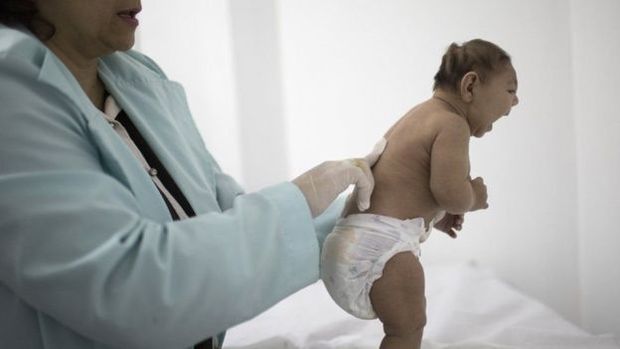 Epidemia de zika gerou alerta na OMS por causa de relao com microcefalia