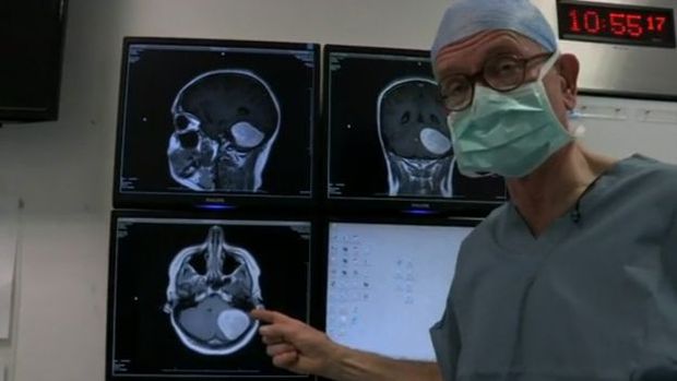 Henry Marsh mostra um scaner de um tumor cerebral 