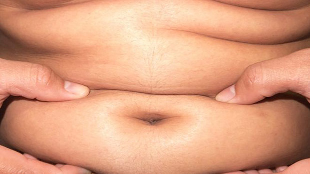 O excesso de gordura pode provocar uma srie de problemas de sade 