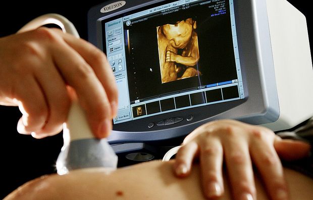 Mulher v imagem de beb durante exame de ultrassom