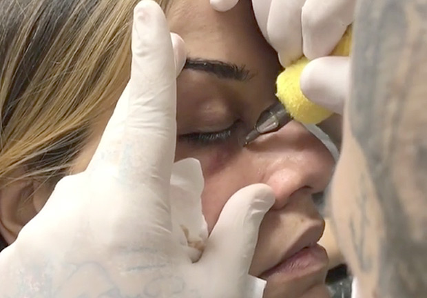 Rodolpho Torres aplicando procedimento contra olheiras