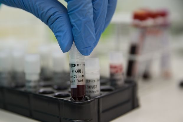 Cientista manipula amostra com sangue contaminado, obtido de paciente que teve zika