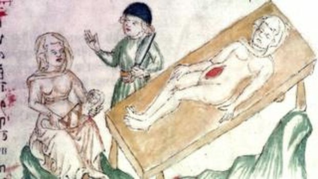 Na era medieval, os mdicos j entendiam que o problema afetava tanto mulheres quanto homens