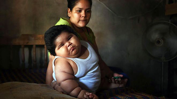 O tratamento de bebs obesos  nutricional 