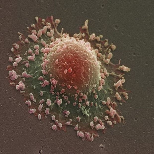 Pesquisadores acreditam que descoberta sobre mutações ajudará em tratamentos contra câncer