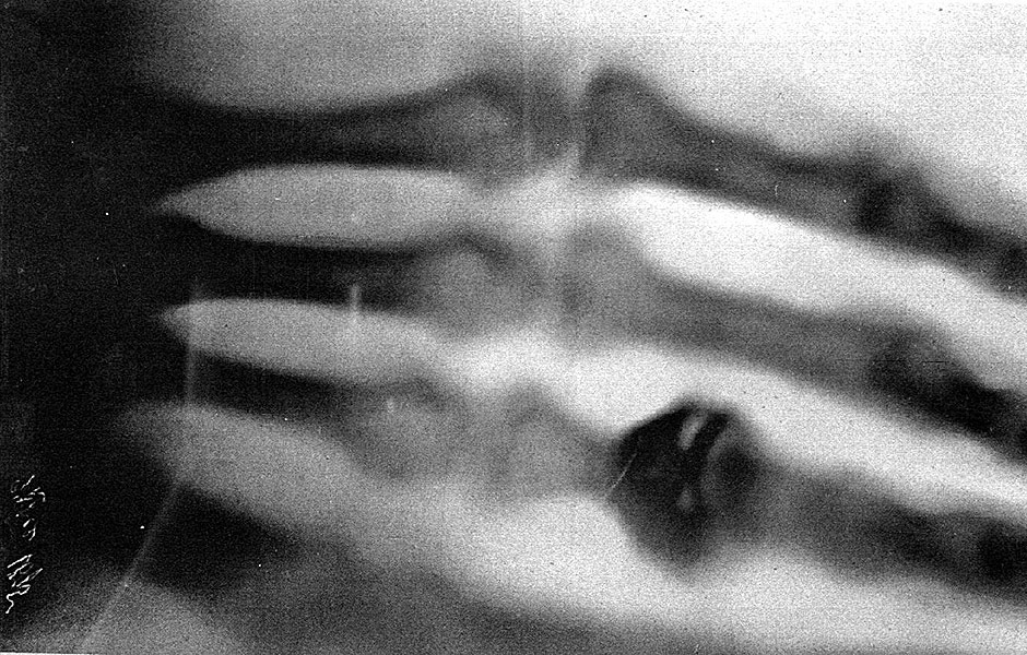 A primeira radiografia da histria, tirada da mo da mulher do fsico Wilhelm Conrad Rntgen