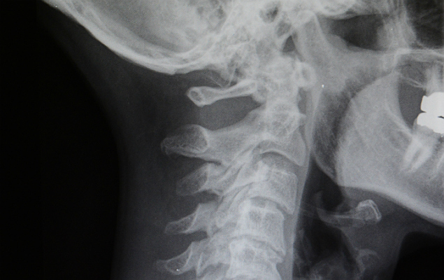 Radiografia de espinha dorsal