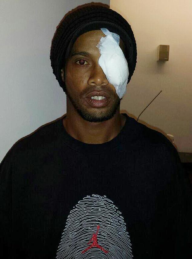 Ronaldinho publica foto com tampo no olho aps ir ao oftalmologista 