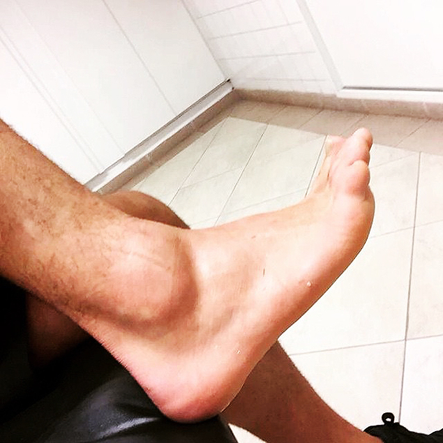 Imagem do tornozelo direito do atacante Alexandre Pato