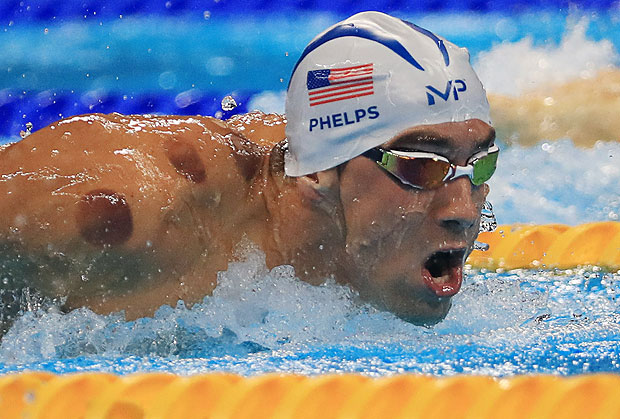 2016 Rio Olympics - Swimming - Preliminary - Men's 200m Butterfly - Heats - Olympic Aquatics Stadium - Rio de Janeiro, Brazil - 08/08/2016. Michael Phelps (USA) of USA is seen with red cupping marks on his shoulder as he competes. REUTERS/Dominic Ebenbichler FOR EDITORIAL USE ONLY. NOT FOR SALE FOR MARKETING OR ADVERTISING CAMPAIGNS. ORG XMIT: OLYCN33