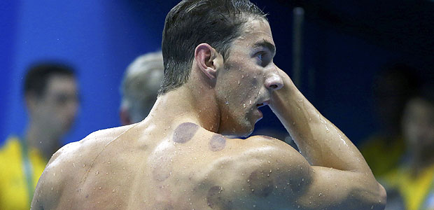 2016 Rio Olympics - Swimming - Preliminary - Men's 200m Butterfly - Heats - Olympic Aquatics Stadium - Rio de Janeiro, Brazil - 08/08/2016. Michael Phelps (USA) of USA is seen with red cupping marks on his shoulder as he competes. REUTERS/Michael Dalder FOR EDITORIAL USE ONLY. NOT FOR SALE FOR MARKETING OR ADVERTISING CAMPAIGNS. ORG XMIT: VP26