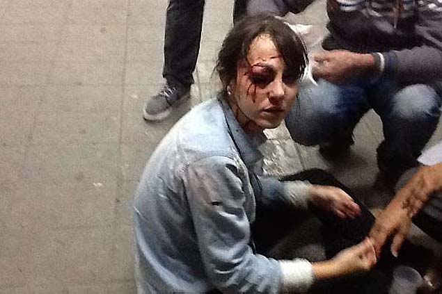 Giuliana Vallone, repórter da Folha, que foi atingida por um disparo de bala de borracha da tropa de choque da polícia militar 