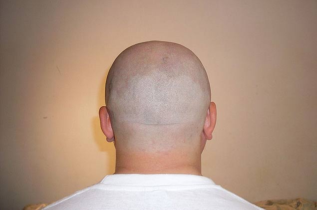homem careca - bald man - https://commons.wikimedia.org/wiki/File:Bald_Man's_Nape.jpg