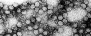 Domínio Público Brasil "importó" el virus de la fiebre amarilla del norte de América del Sur
