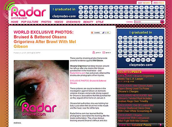 Oksana Grigorieva aparece com olho roxo em foto do site Radar Online