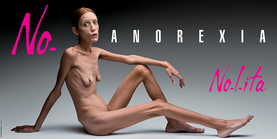 A modelo francesa Isabelle Caro em foto feita pelo fotgrafo Oliviero Toscani