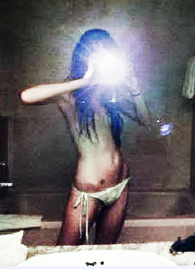 Imagem de projeto sobre anorexia da espanhola Laia Abril