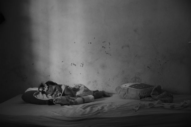 RECIFE, PERNAMBUCO, BRAZIL. 23/10/2016. Pérola, 1 year-old, born with microcephaly caused by the Zika virus, sleeps in the bed of a friend of his mother in Recife where the girl is been monitored. The family lives in Betânia, a town about 400 km from Recife, which is the closest place to monitor the girl's microcephaly. ( Photo: Lalo de Almeida ) ***DIREITOS RESERVADOS. NO PUBLICAR SEM AUTORIZAO DO DETENTOR DOS DIREITOS AUTORAIS E DE IMAGEM***