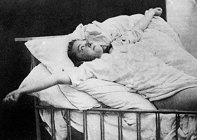 ORG XMIT: 264401_0.tif Augustine, paciente de Charcot, professor de Freud, fotografada em estado histérico-epiléptico no hospital francês La Salpêtriãre. 