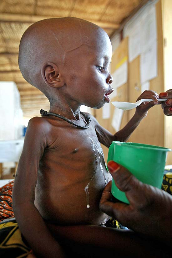 ONU quer impedir que crise alimentícia se transforme em crise de fome no Níger; desnutrição é um dos problemas