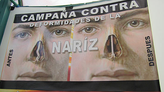 Campanha boliviana estimula indígenas a fazerem cirurgia plástica para reduzir tamanho de nariz