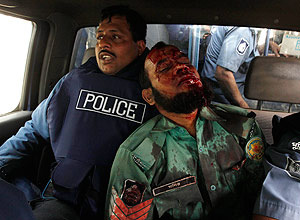 Policial ferido em confrontos com manifestantes  levado para hospital na capital, Dacca