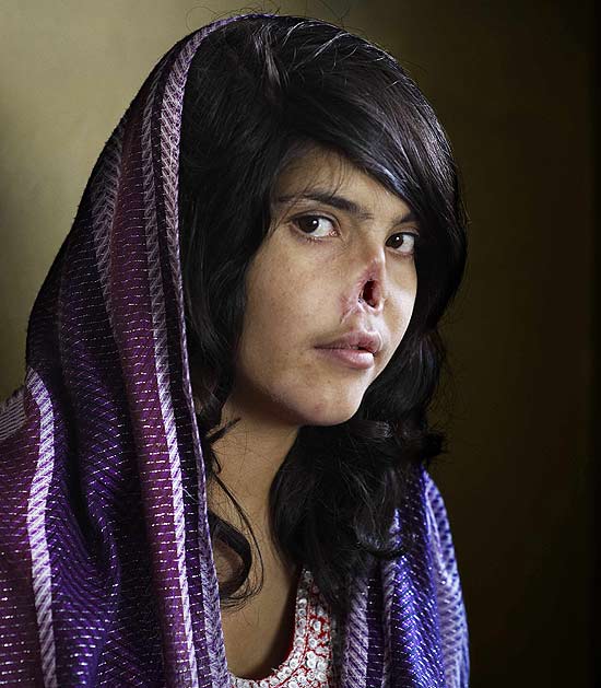 Foto da sul-africana Jodi Bieber mostra a beleza e tragédia por trás da afegã Bibi Aisha, mutilada pelo marido