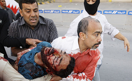 Manifestante no-identificado  carregado aps ser ferido no Bahrein; Exrcito atirou contra manifestantes