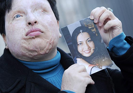A iraniana Ameneh Bahrami mostra sua fotografia antes de ficar cega e deformada por ataque de ácido no Irã