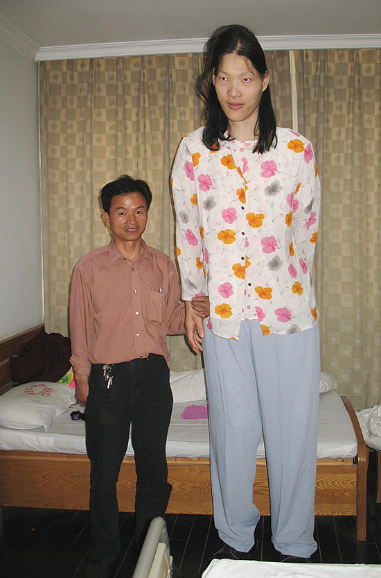 Yao Defen, de 2,23m, com um irmão mais velho em hospital de Anhui, na China; ela morreu em novembro 