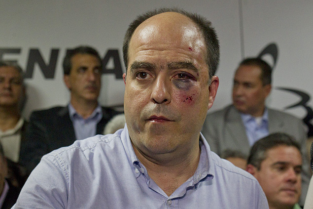 Deputado da oposio Julio Borges com marcas das agresses recebidas durante tumulto na Assembleia Nacional nesta tera-feira(30). EFE/Boris Vergara ORG XMIT: CAR102